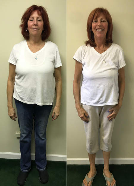 debbiebeforeandafter