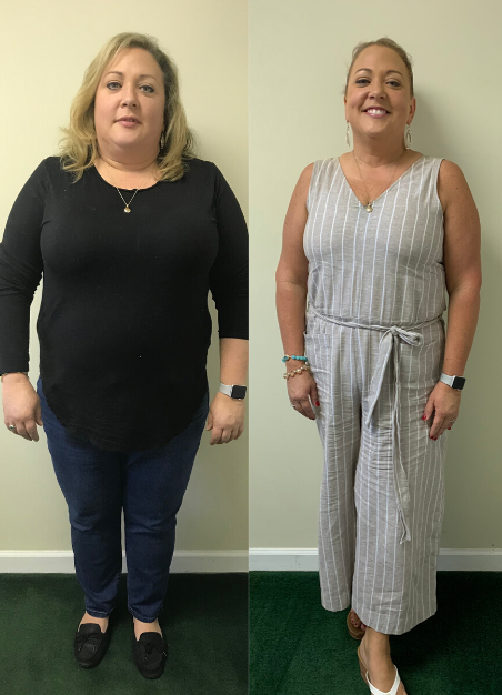 melissabeforeandafter