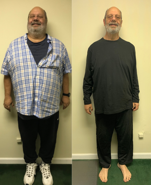 stevebeforeandafter